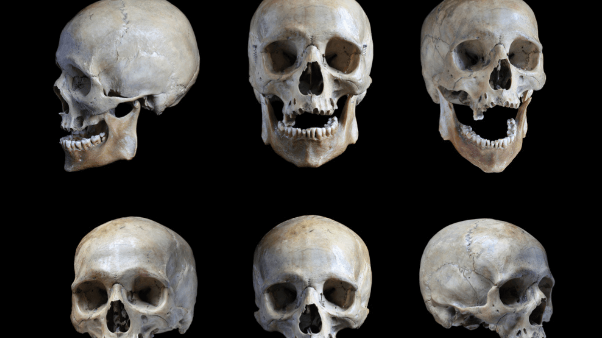 Human skull in different angles MSN