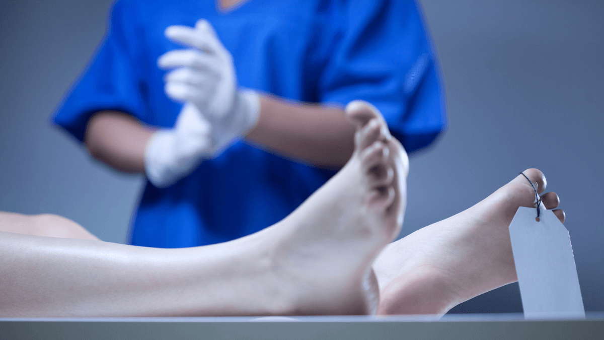 Dead body lying in mortuary